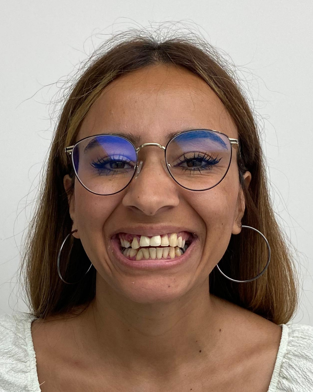 Öncesi